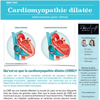 Cardiomyopathie dilatée