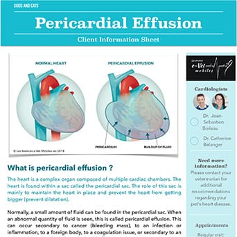 Pericardial Effusion
