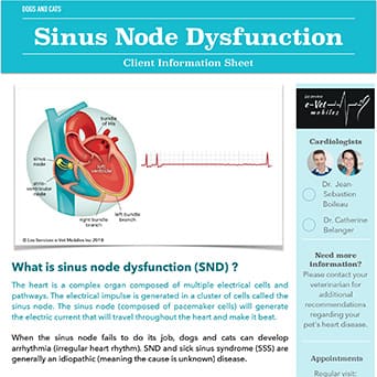 Sinus Node Dysfunction