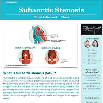 Subaortic Stenosis