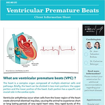 Ventricular Premature Beats