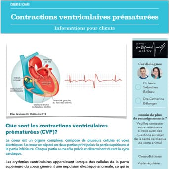 Contractions ventriculaires prématurées